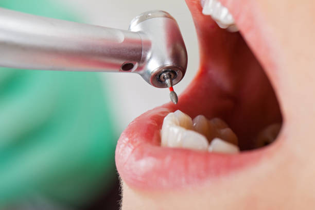 Best Knocked-Out Tooth Emergency  in Grand Marais, MN
